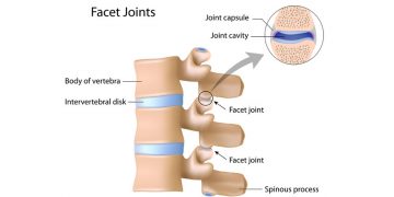 The Facet Joint
